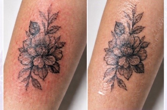 Inner Forearm